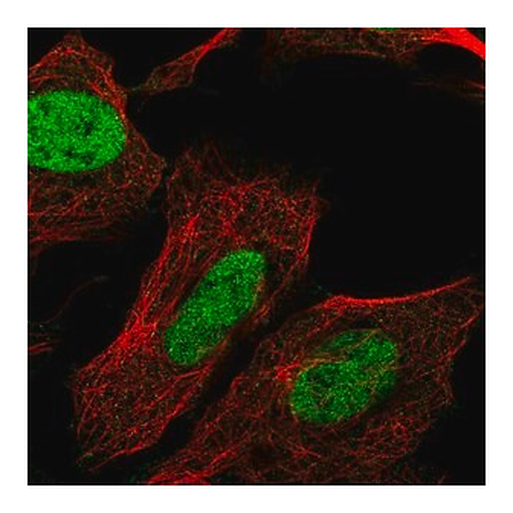 Merck Anti-CHTF8 antibody produced in rabbit