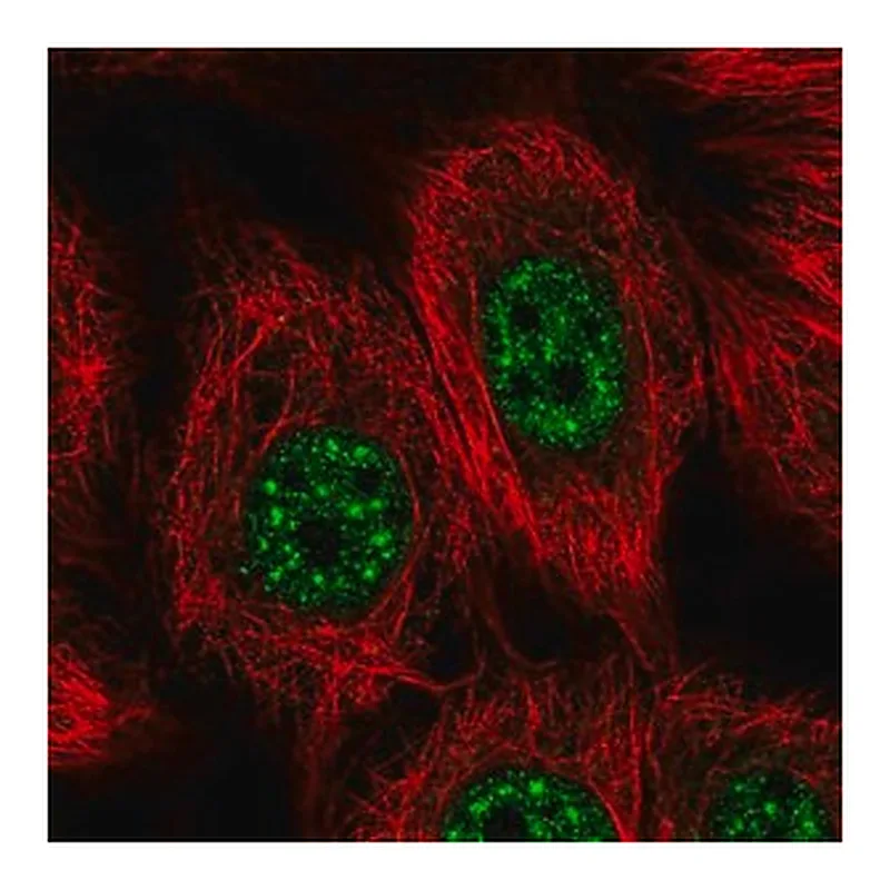 Merck Anti-VPS72 antibody produced in rabbit