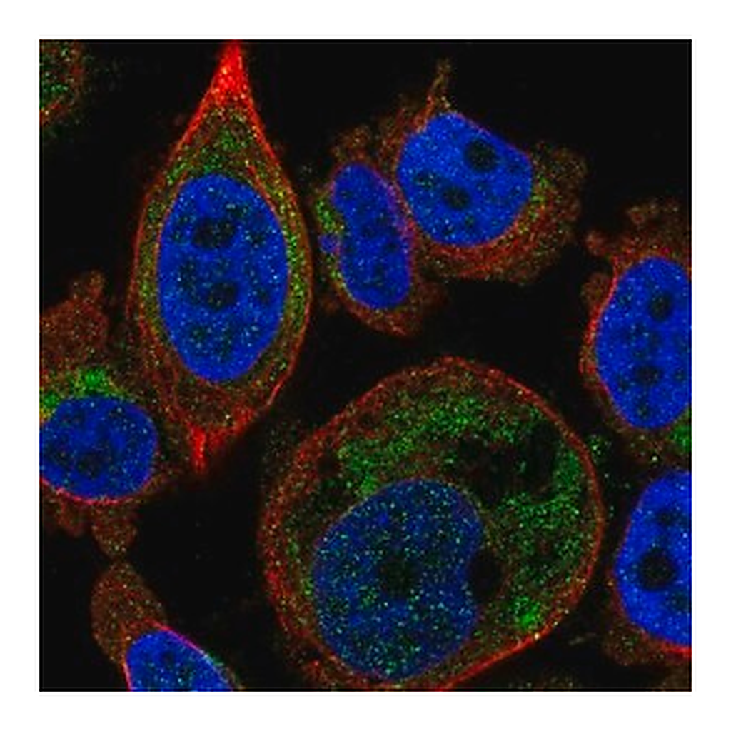 Merck Anti-SLC25A16 antibody produced in rabbit