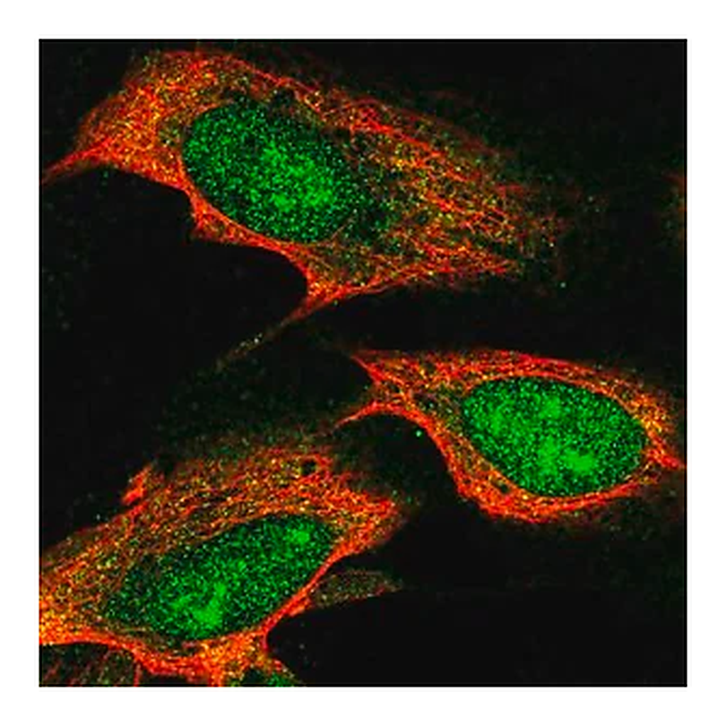 Merck Anti-TTC3 antibody produced in rabbit
