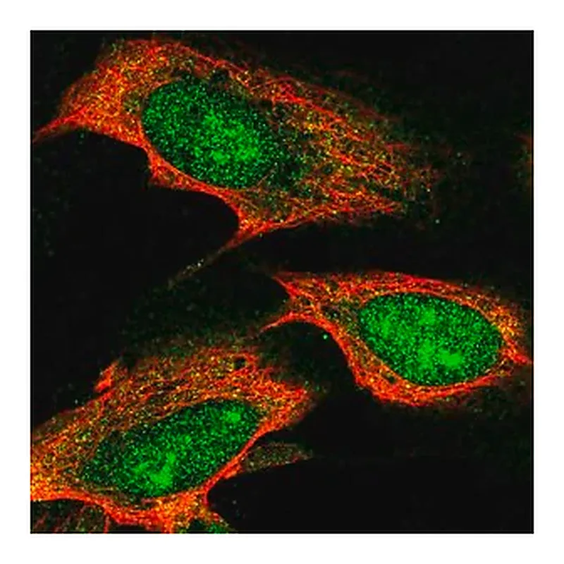 Merck Anti-TTC3 antibody produced in rabbit