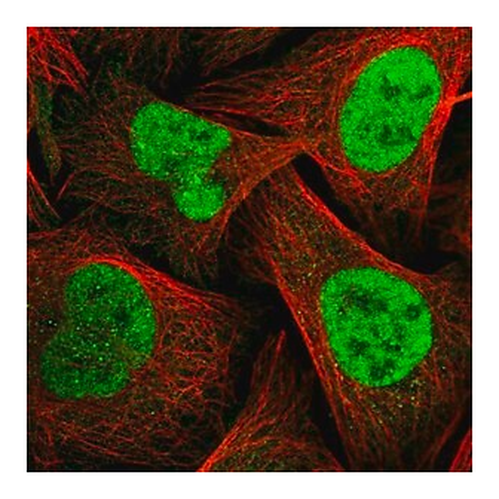 Merck Anti-TOPBP1 antibody produced in rabbit