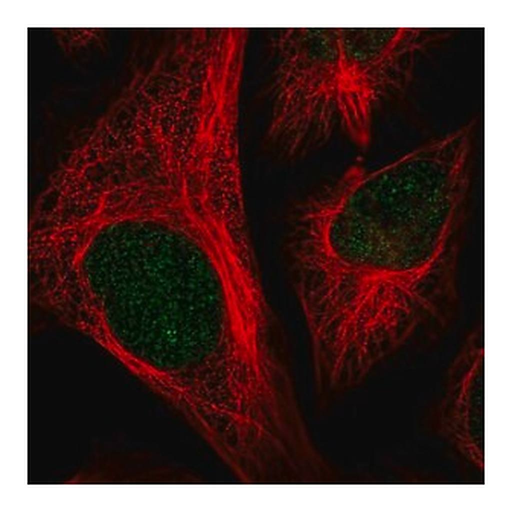 Merck Anti-CFAP58 antibody produced in rabbit
