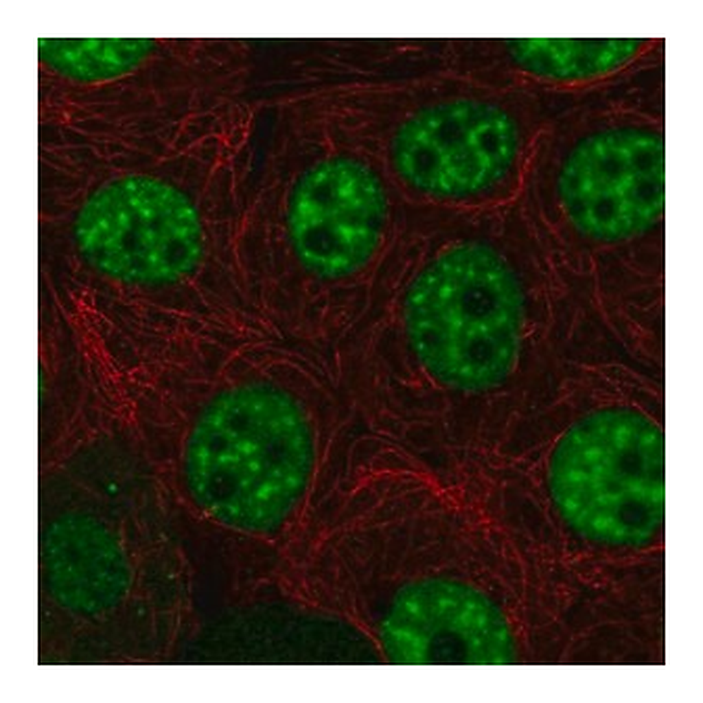 Merck Anti-HELQ antibody produced in rabbit