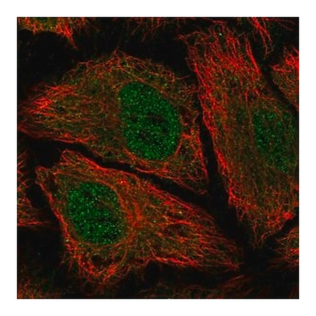 Merck Anti-PDE8B antibody produced in rabbit