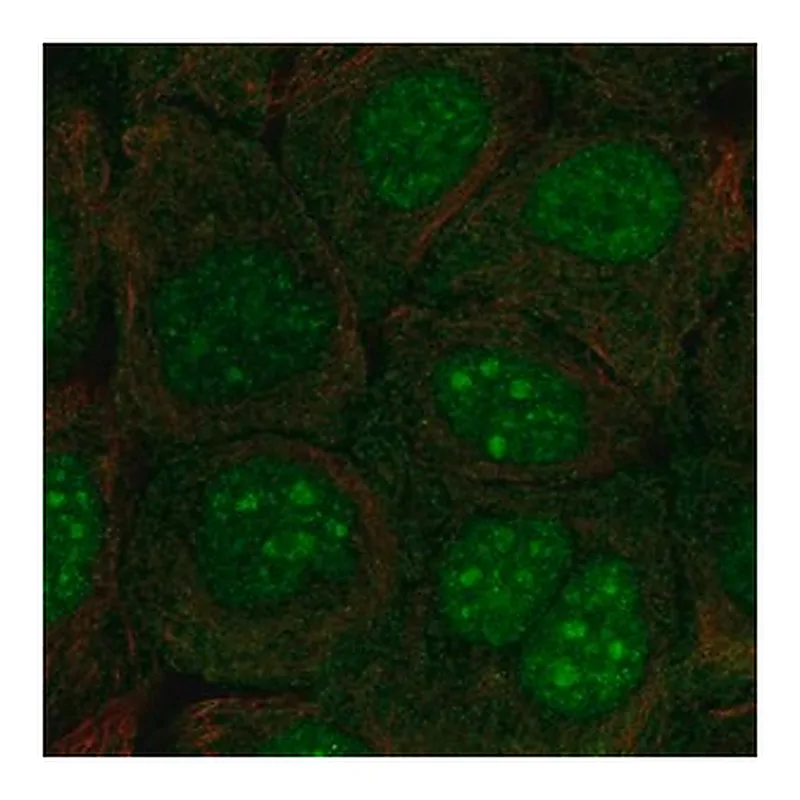 Merck Anti-C10orf67 antibody produced in rabbit