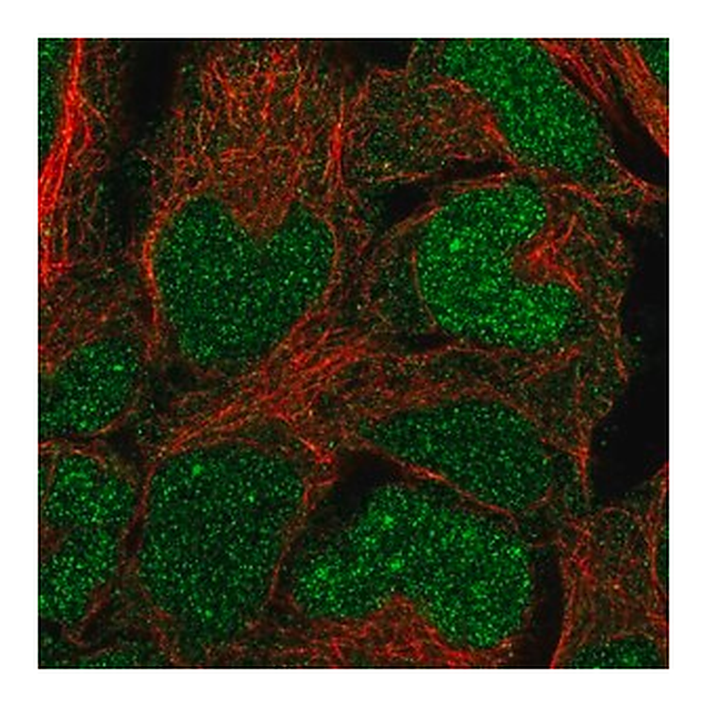Merck Anti-BCCIP antibody produced in rabbit
