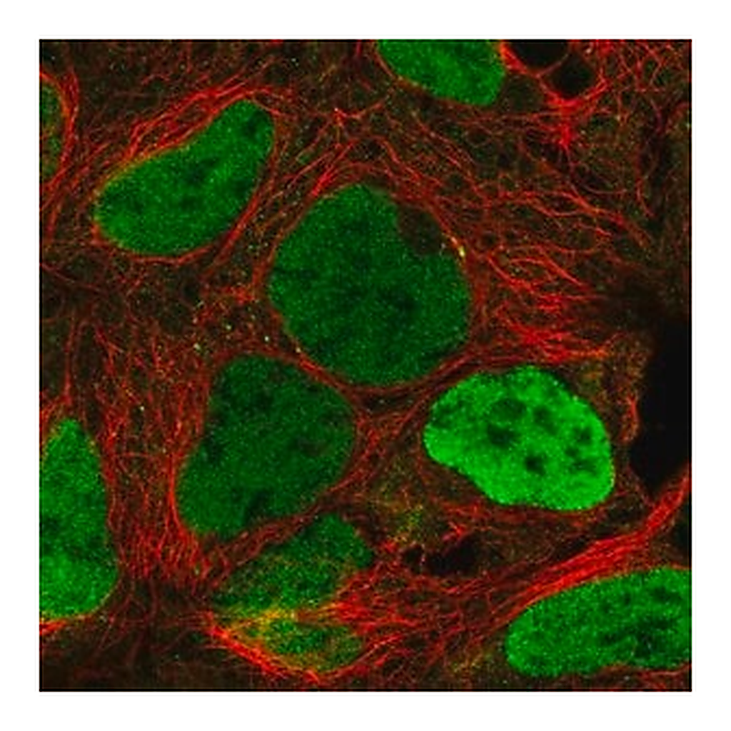 Merck Anti-KDM5C antibody produced in rabbit