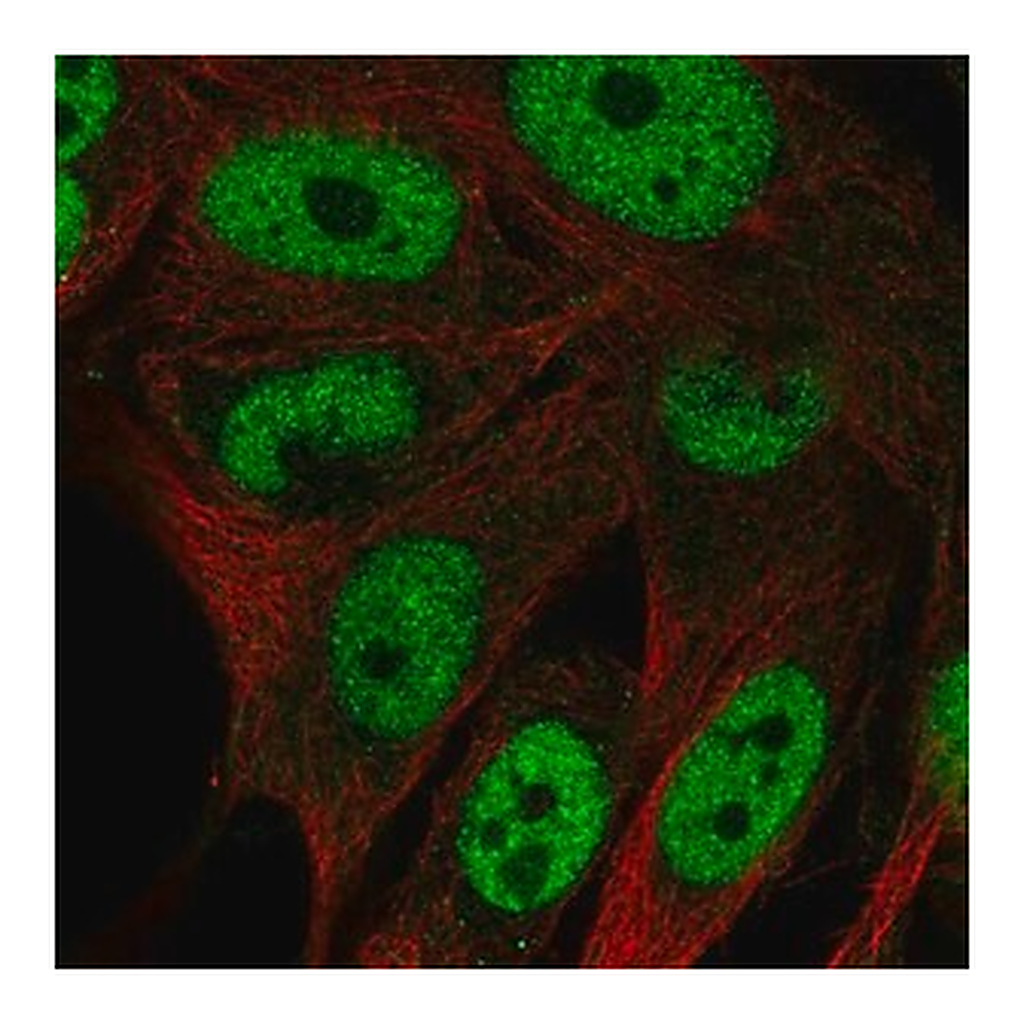 Merck Anti-GAL3ST4 antibody produced in rabbit