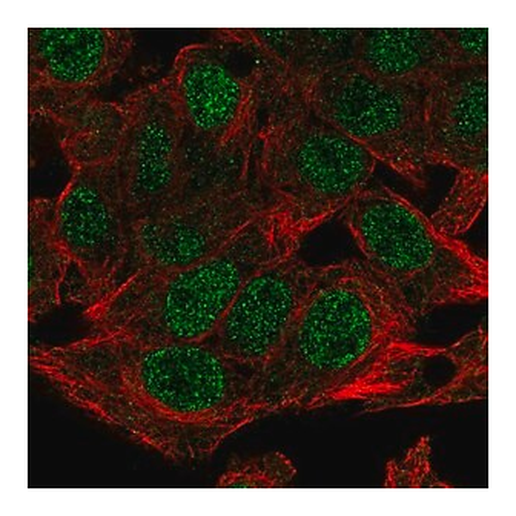 Merck Anti-NSMCE4A antibody produced in rabbit