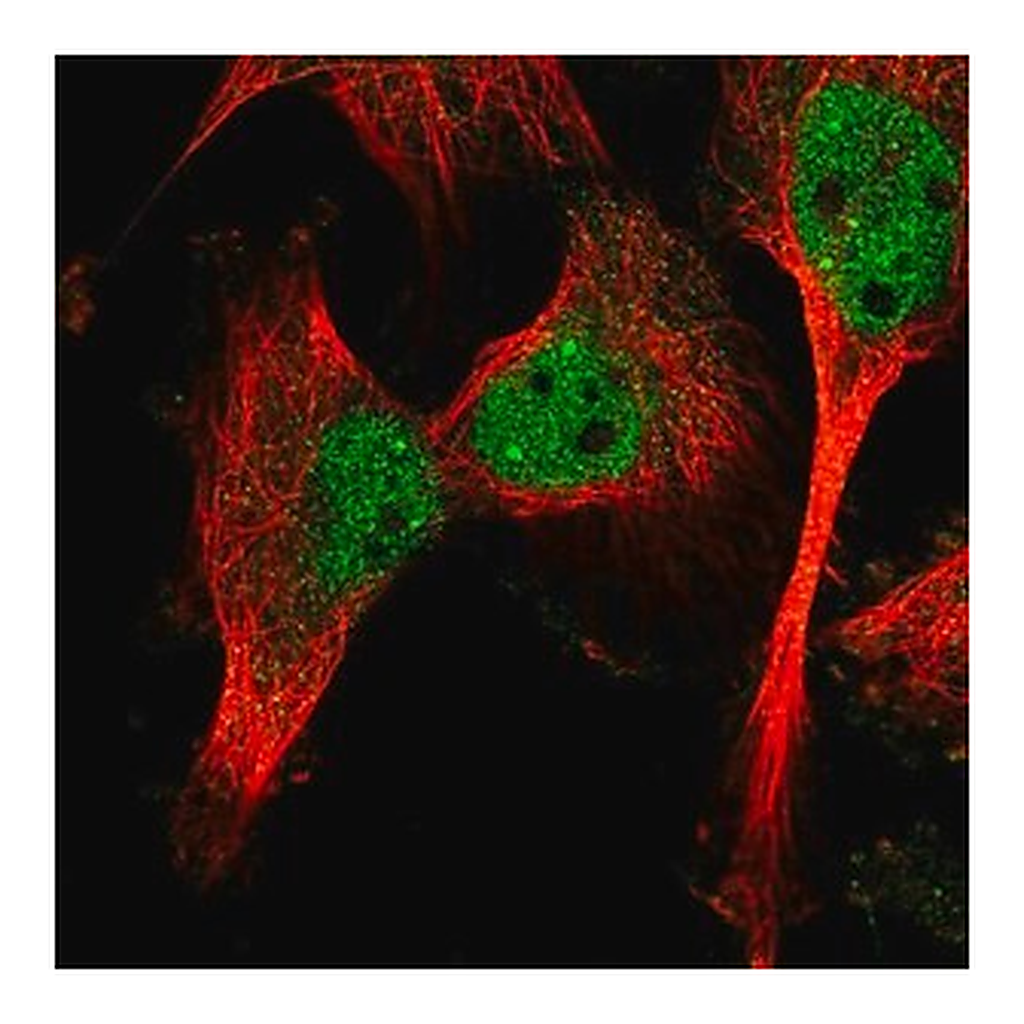 Merck Anti-CAPN10 antibody produced in rabbit