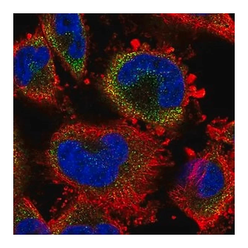 Merck Anti-S100A3 antibody produced in rabbit