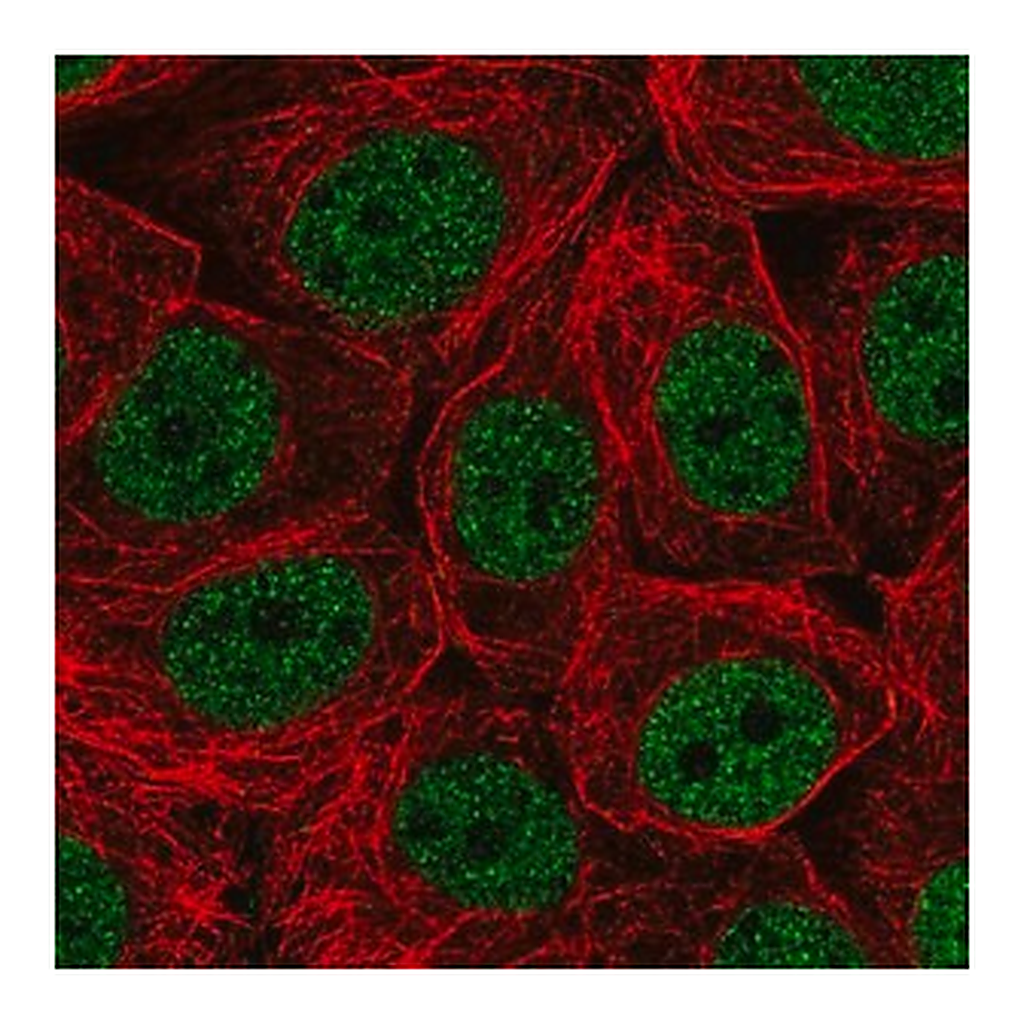 Merck Anti-CHTF18 antibody produced in rabbit