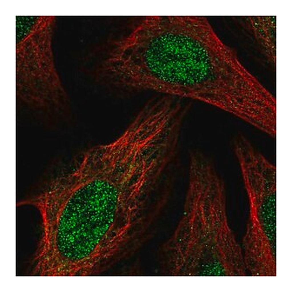 Merck Anti-BCOR antibody produced in rabbit