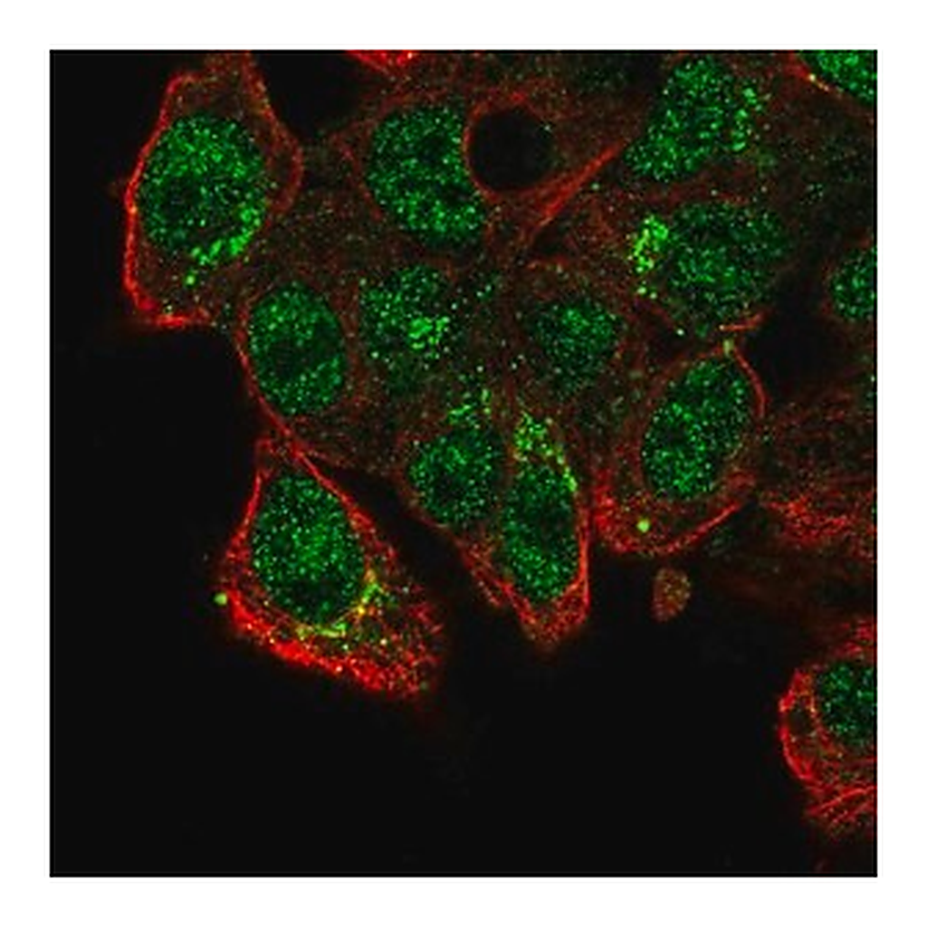 Merck Anti-CADPS2 antibody produced in rabbit