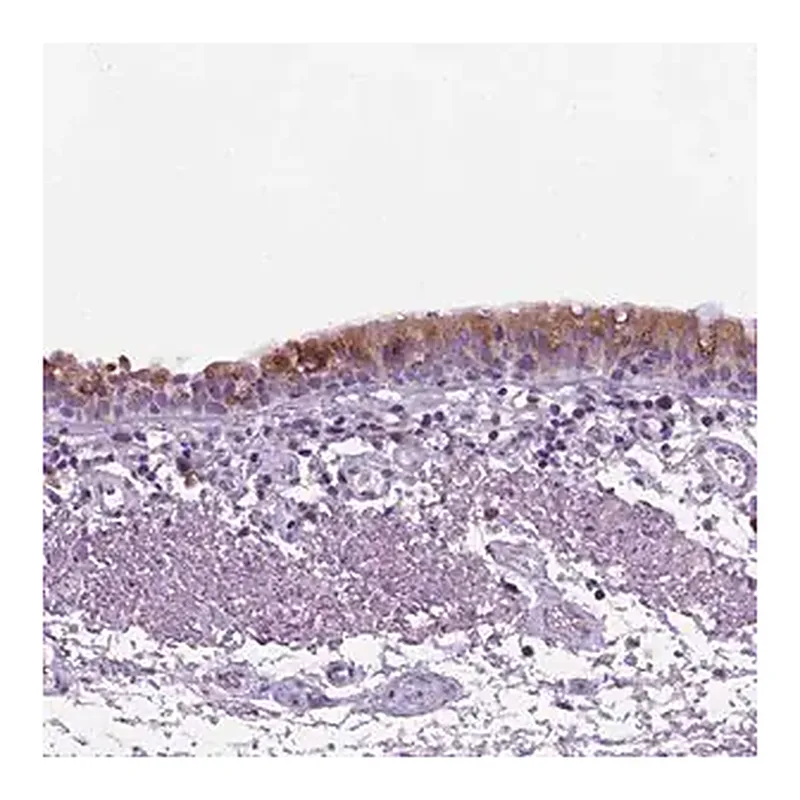 Merck Anti-DNAH11 antibody produced in rabbit