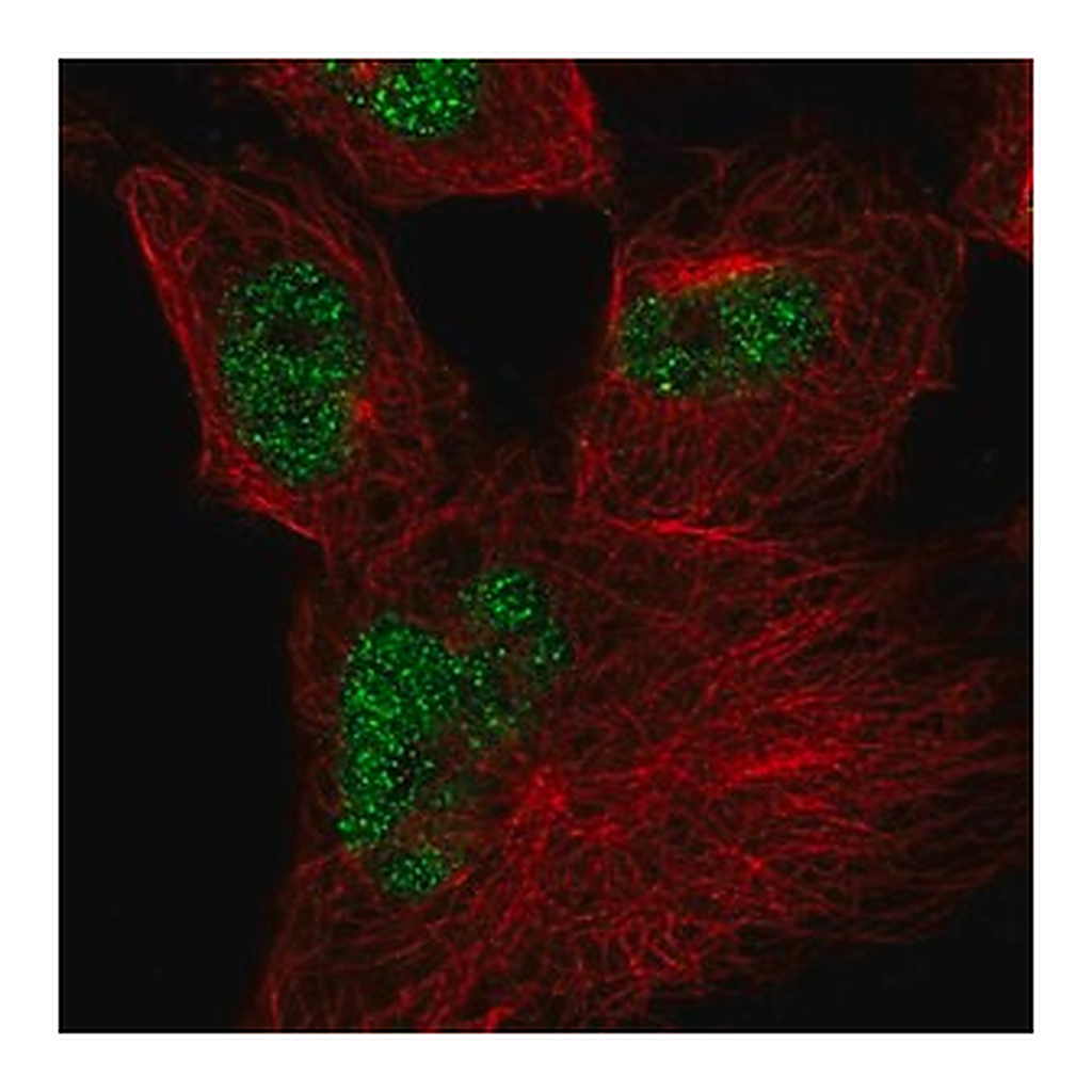 Merck Anti-CWC27 antibody produced in rabbit
