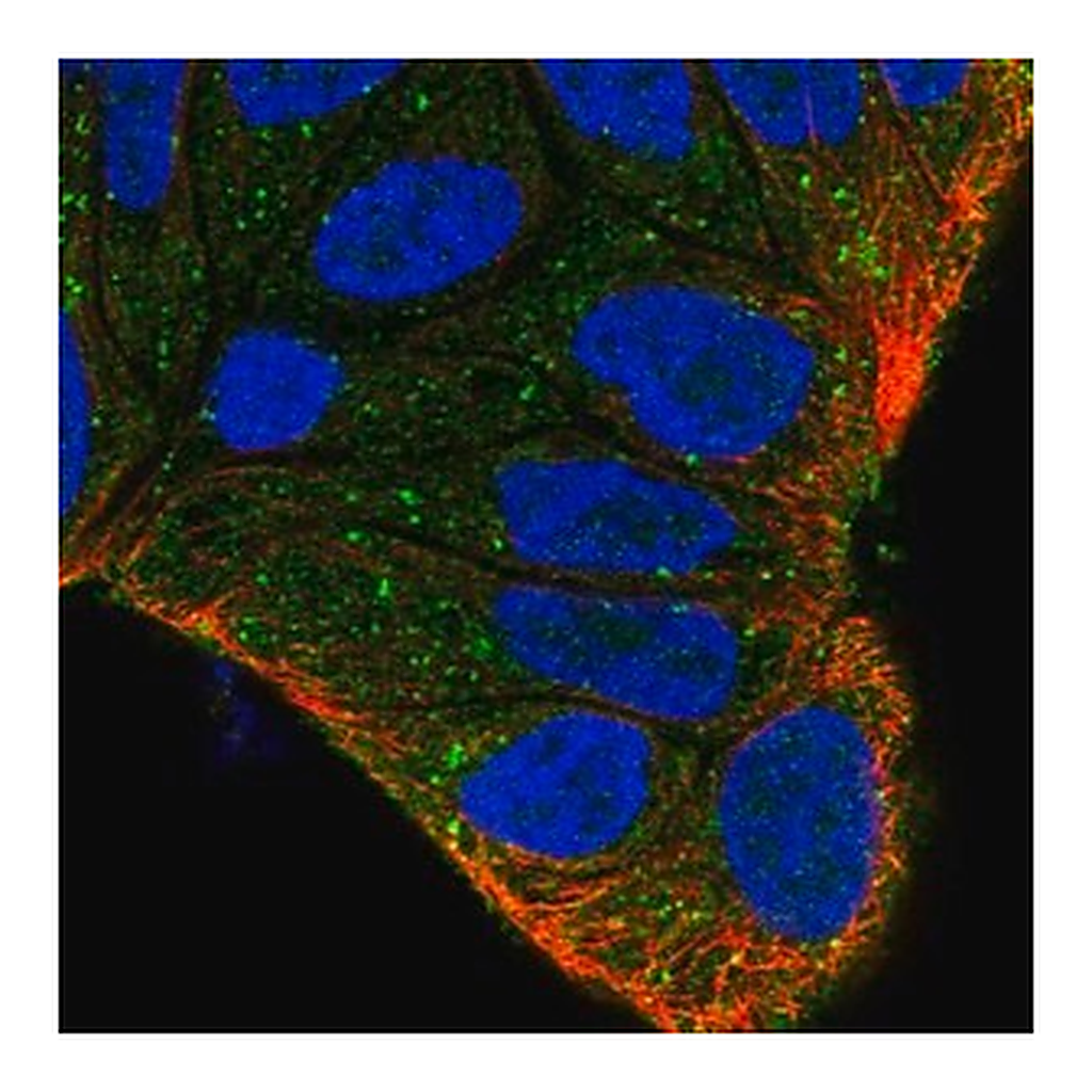 Merck Anti-ZFYVE9 antibody produced in rabbit | 캐시바이