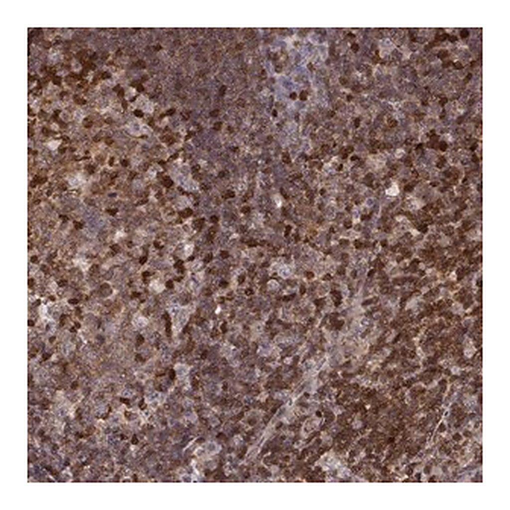 Merck Anti-MFSD1 antibody produced in rabbit