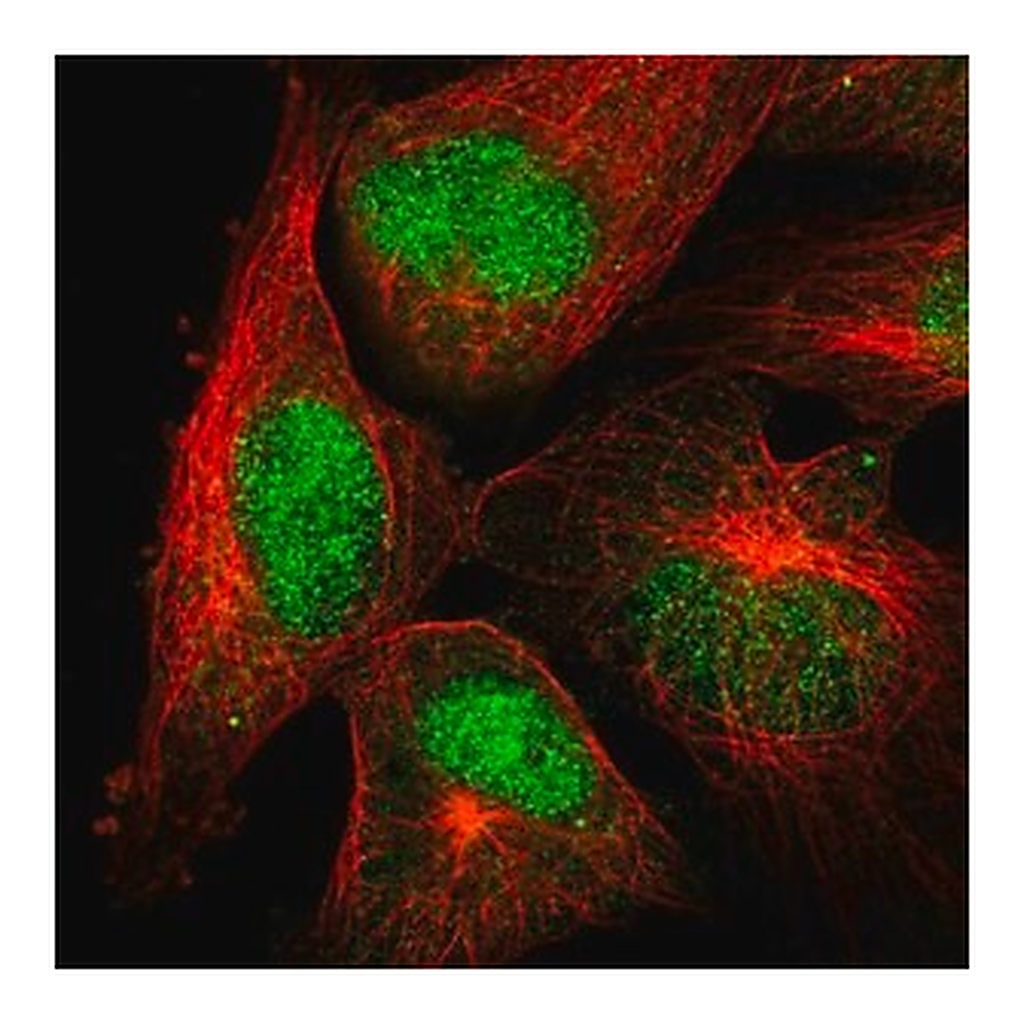 Merck Anti-POLM antibody produced in rabbit