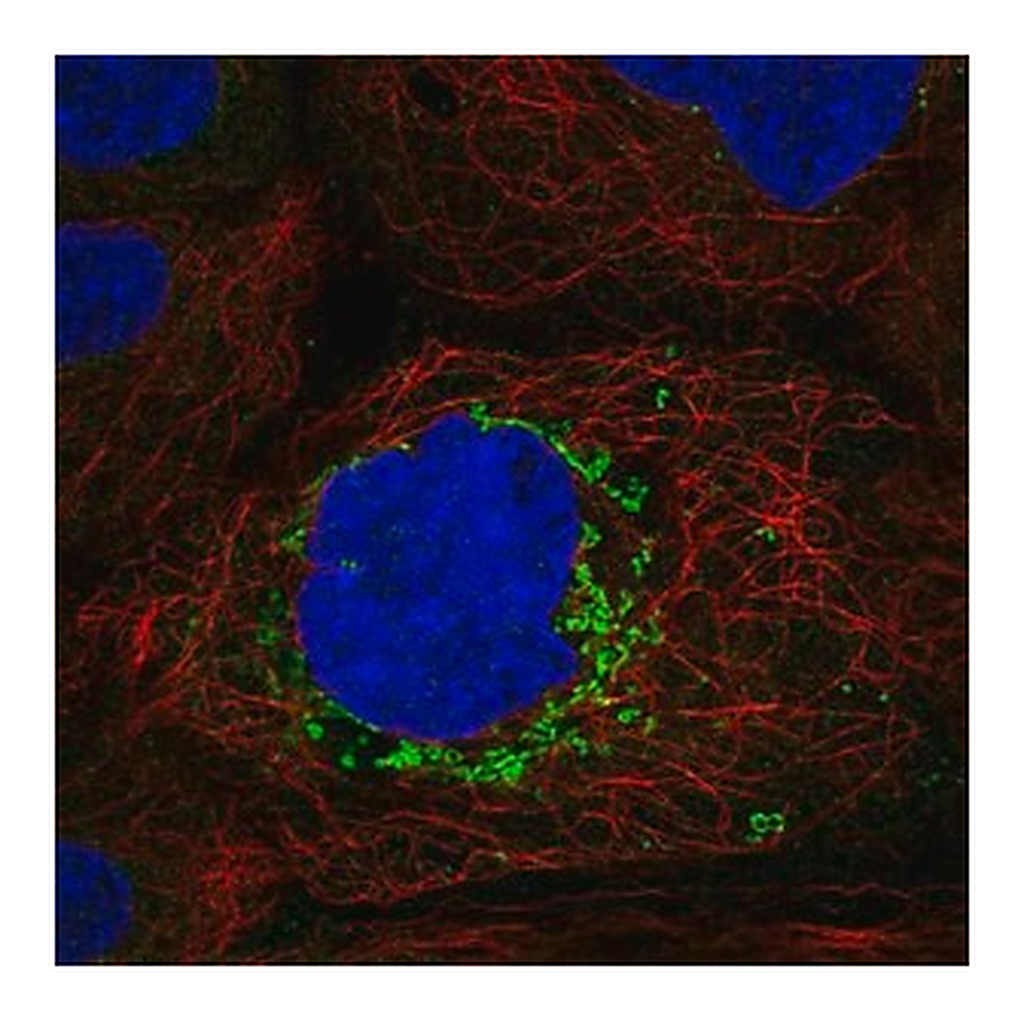 Merck Anti-ABHD10 antibody produced in rabbit