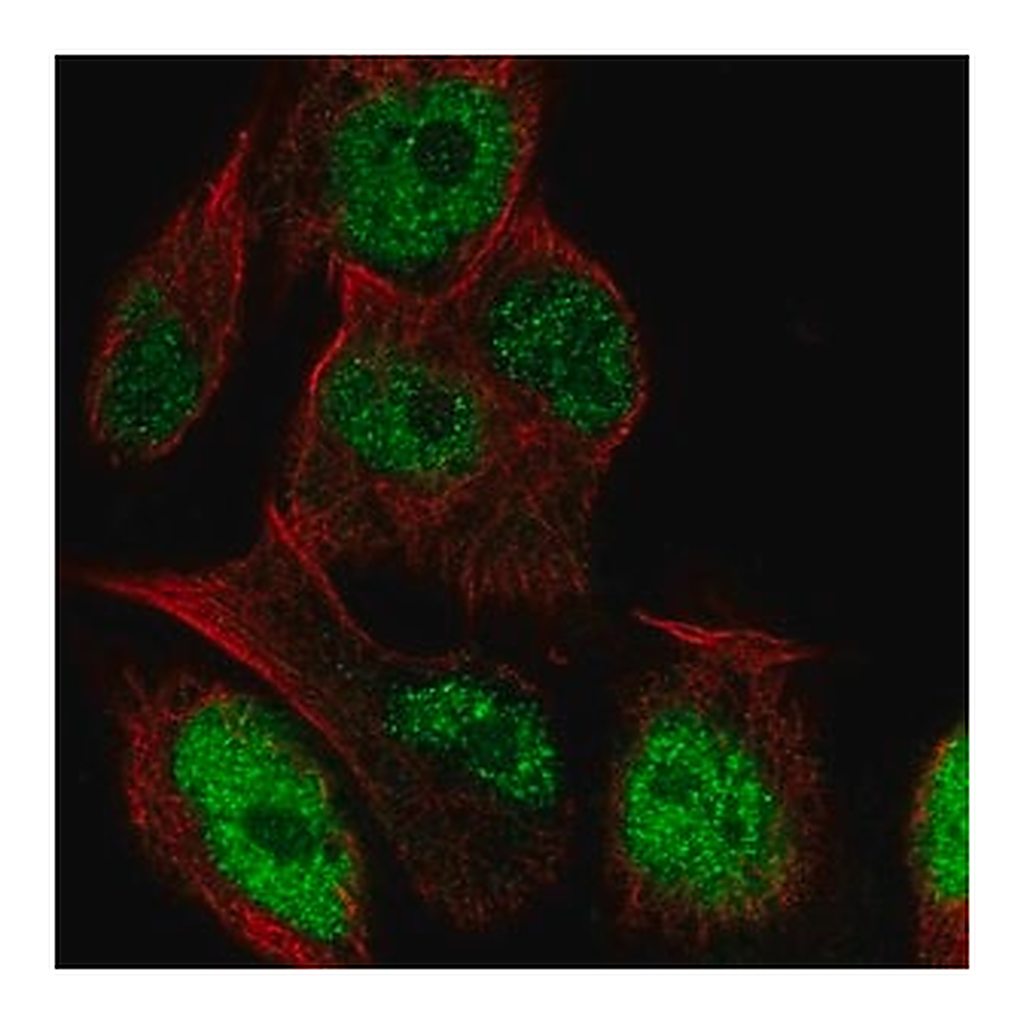 Merck Anti-LRRC28 antibody produced in rabbit