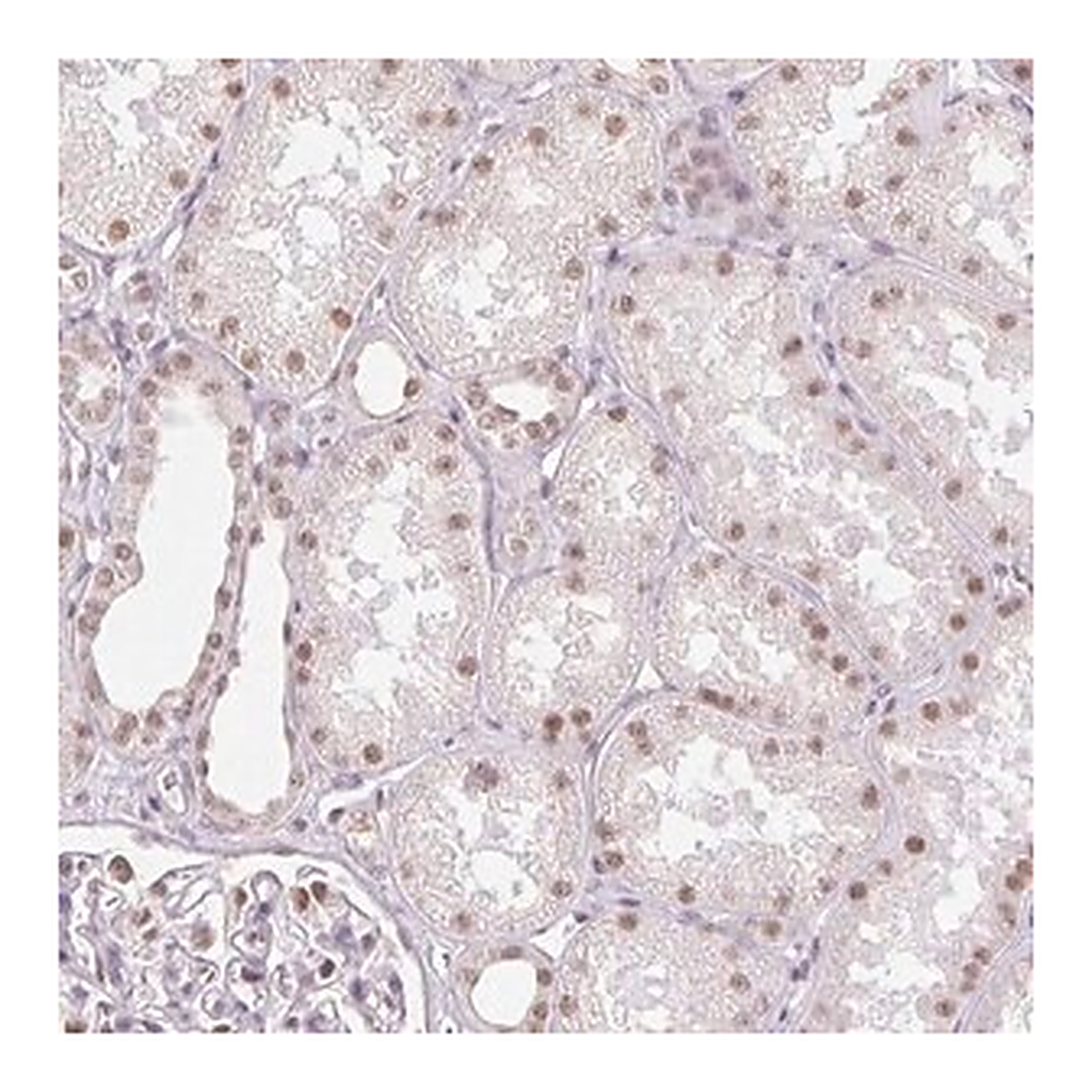 Merck Anti-RPRD1B antibody produced in rabbit
