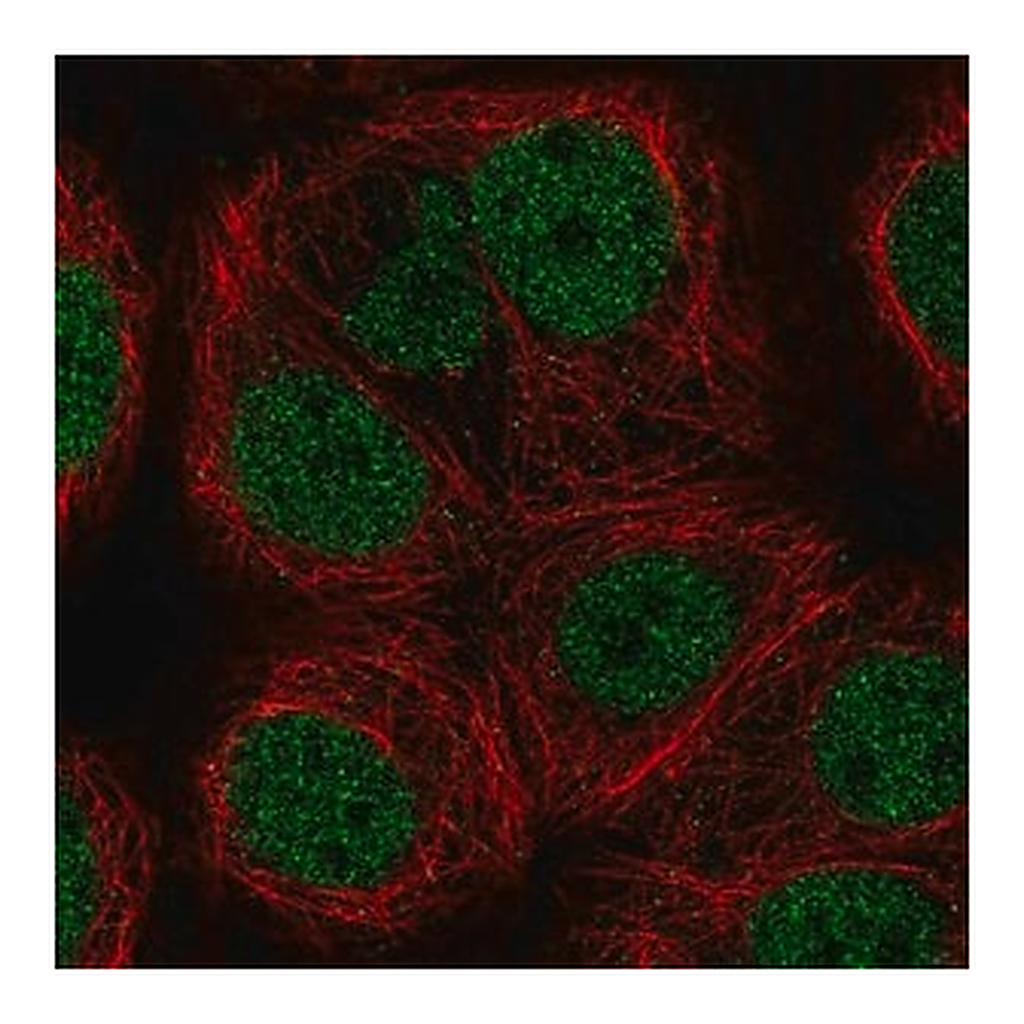 Merck Anti-KAT8 antibody produced in rabbit