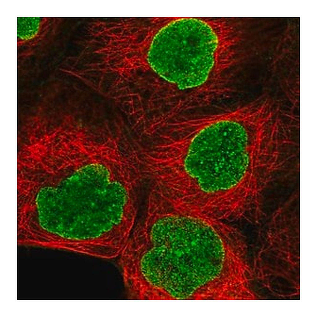 Merck Anti-AMPD3 antibody produced in rabbit