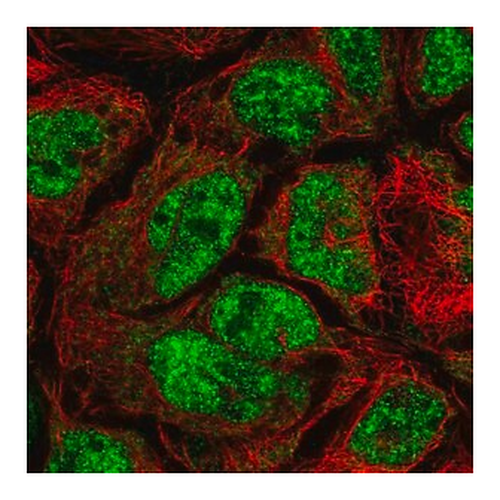 Merck Anti-CDK5RAP1 antibody produced in rabbit