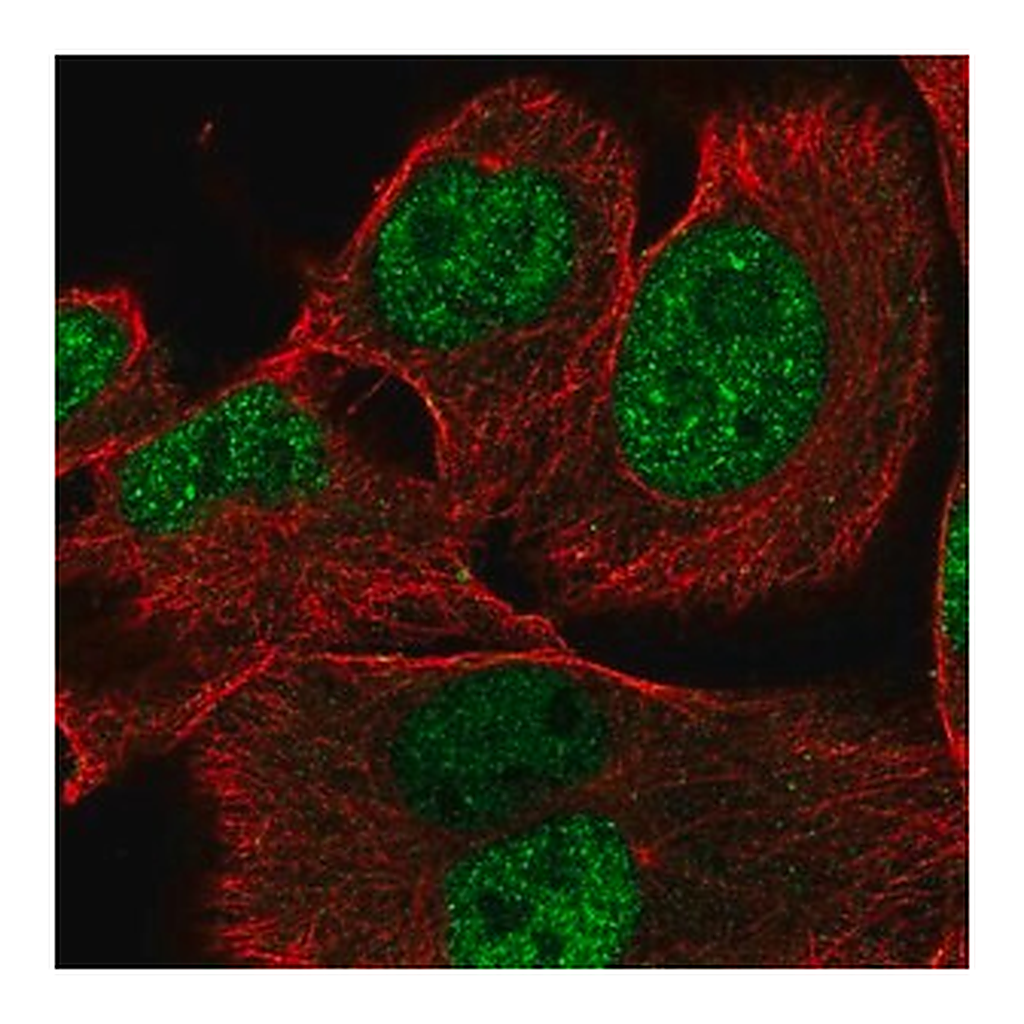 Merck Anti-XRRA1 antibody produced in rabbit