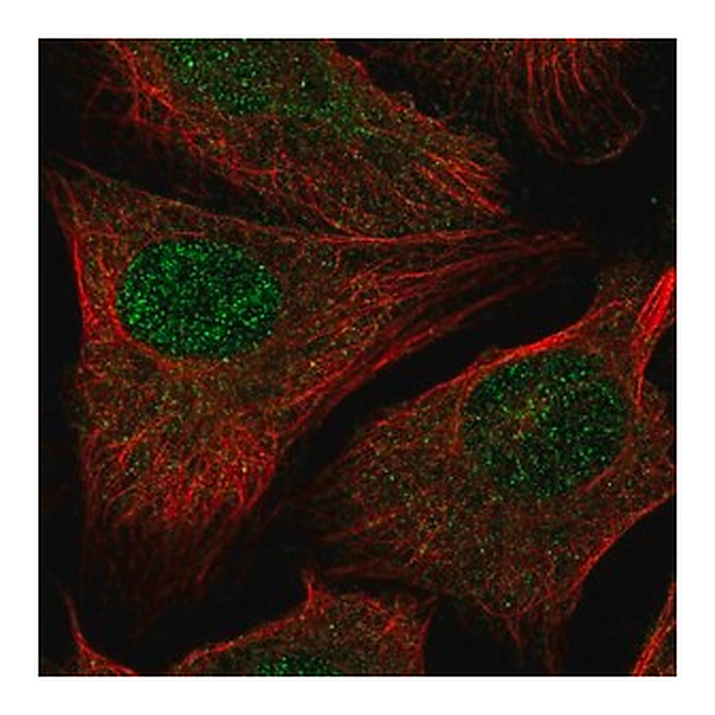Merck Anti-RAD54L2 antibody produced in rabbit