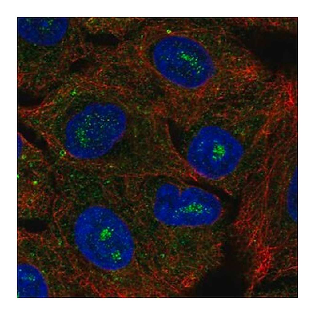 Merck Anti-CACNG6 antibody produced in rabbit