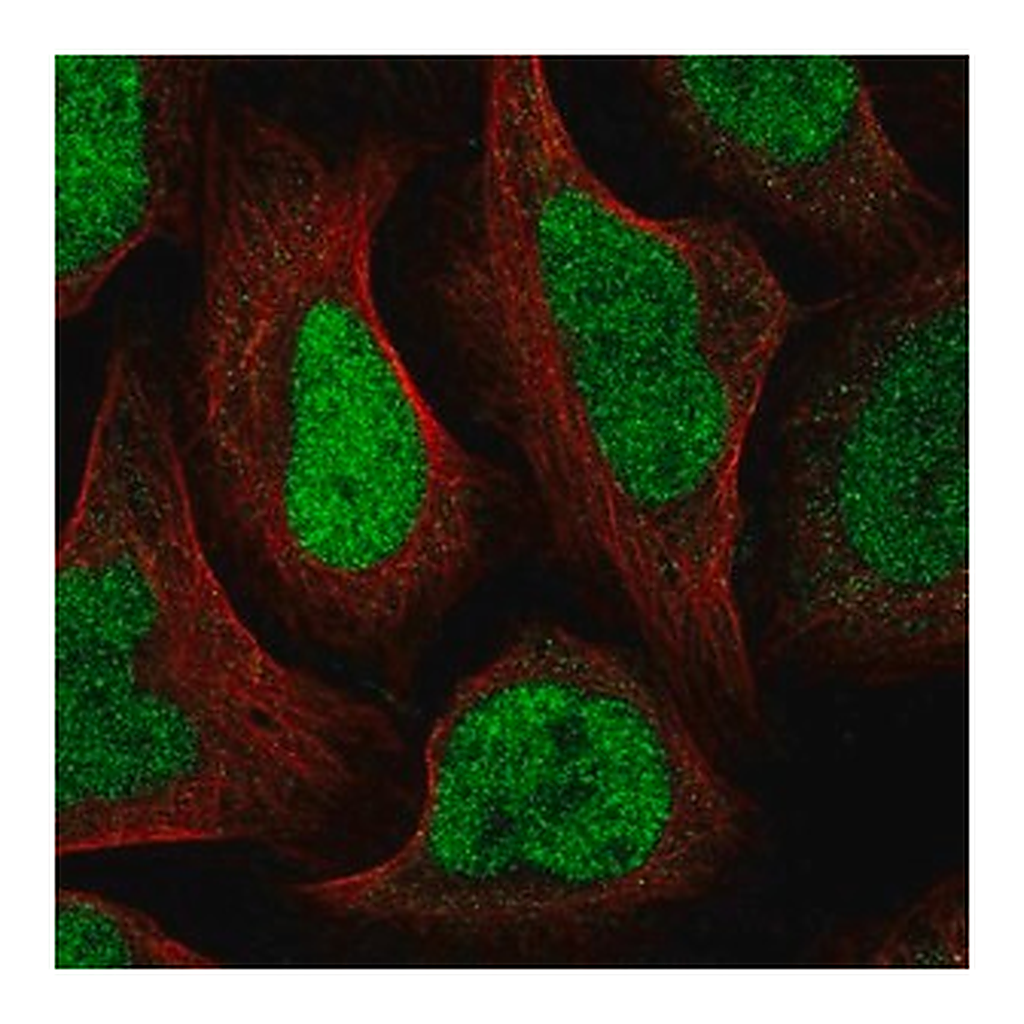 Merck Anti-GTF2IRD2B antibody produced in rabbit