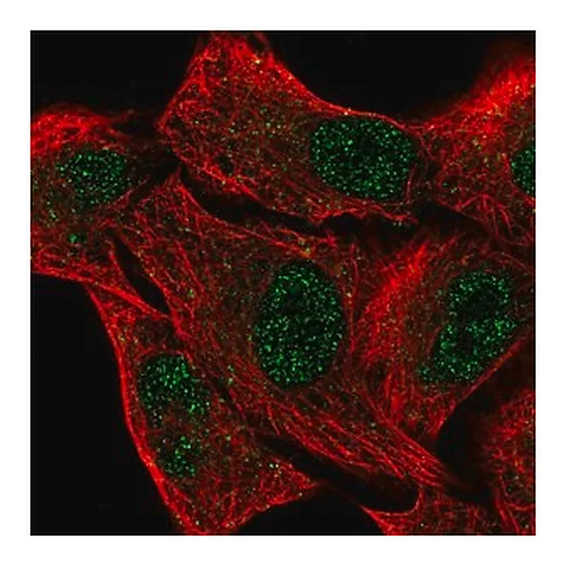 Merck Anti-EGLN2 antibody produced in rabbit