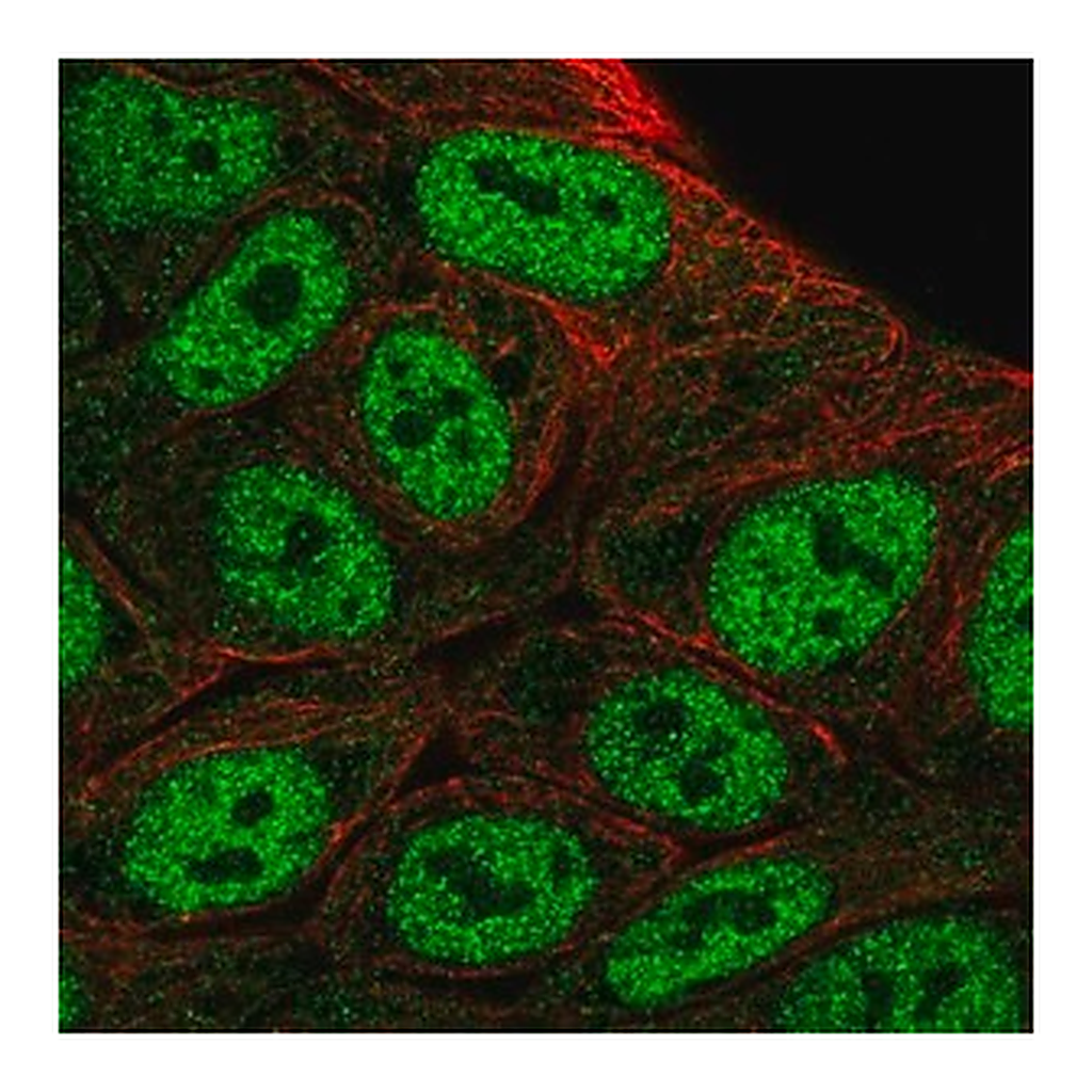 Merck Anti-HOXD1 antibody produced in rabbit
