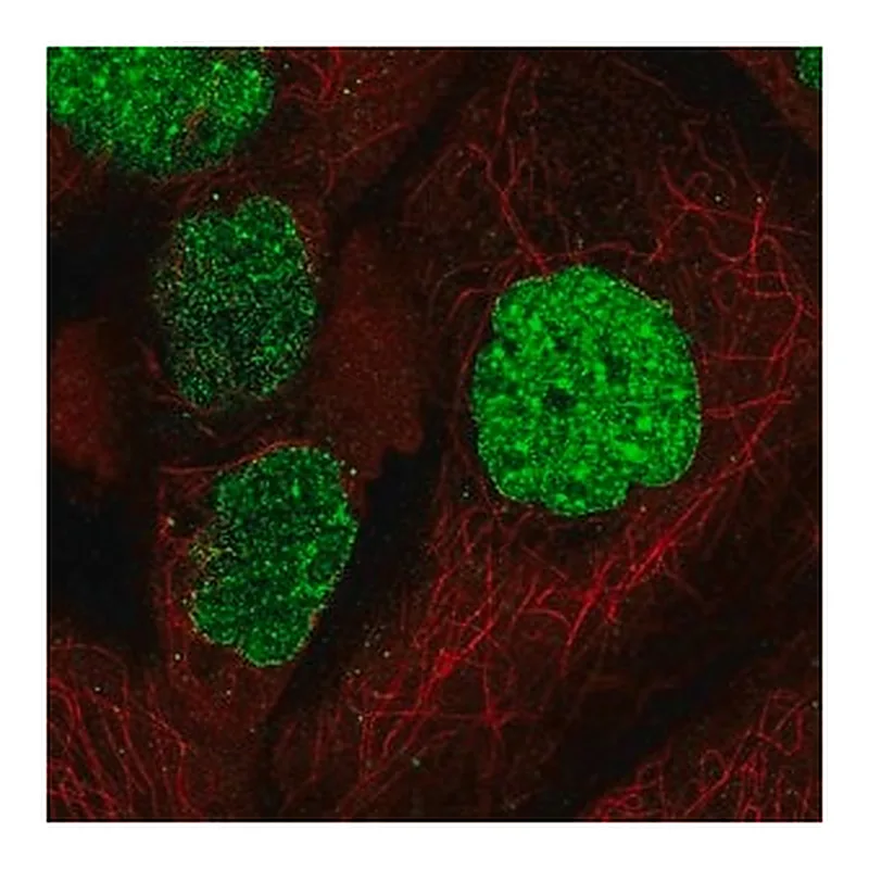 Merck Anti-SUMO1 antibody produced in rabbit
