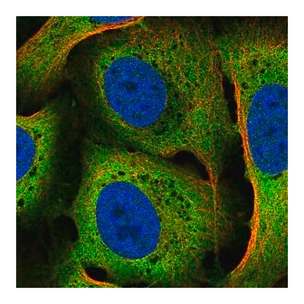 Merck Anti-CACYBP antibody produced in rabbit