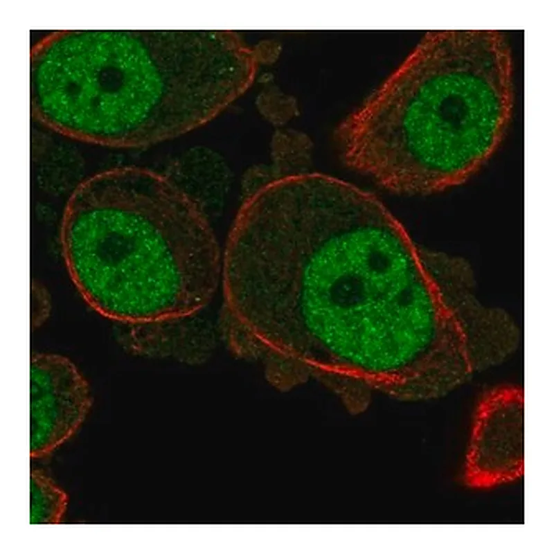 Merck Anti-KCNN3 antibody produced in rabbit