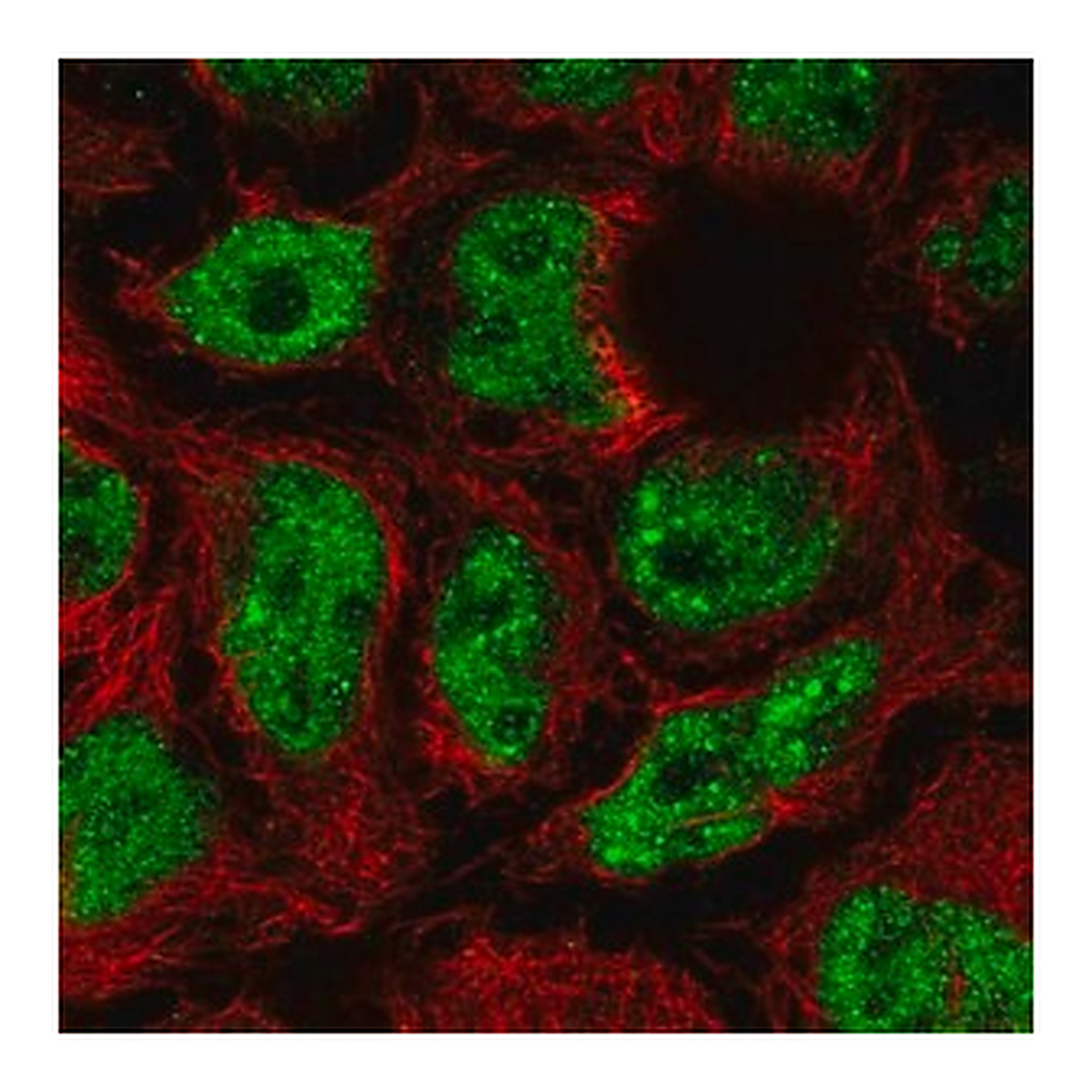 Merck Anti-SKI antibody produced in rabbit