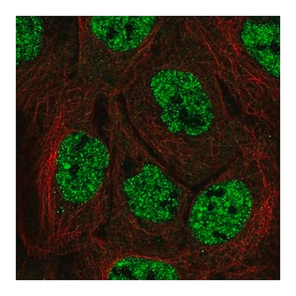 Merck Anti-APOBEC3B antibody produced in rabbit