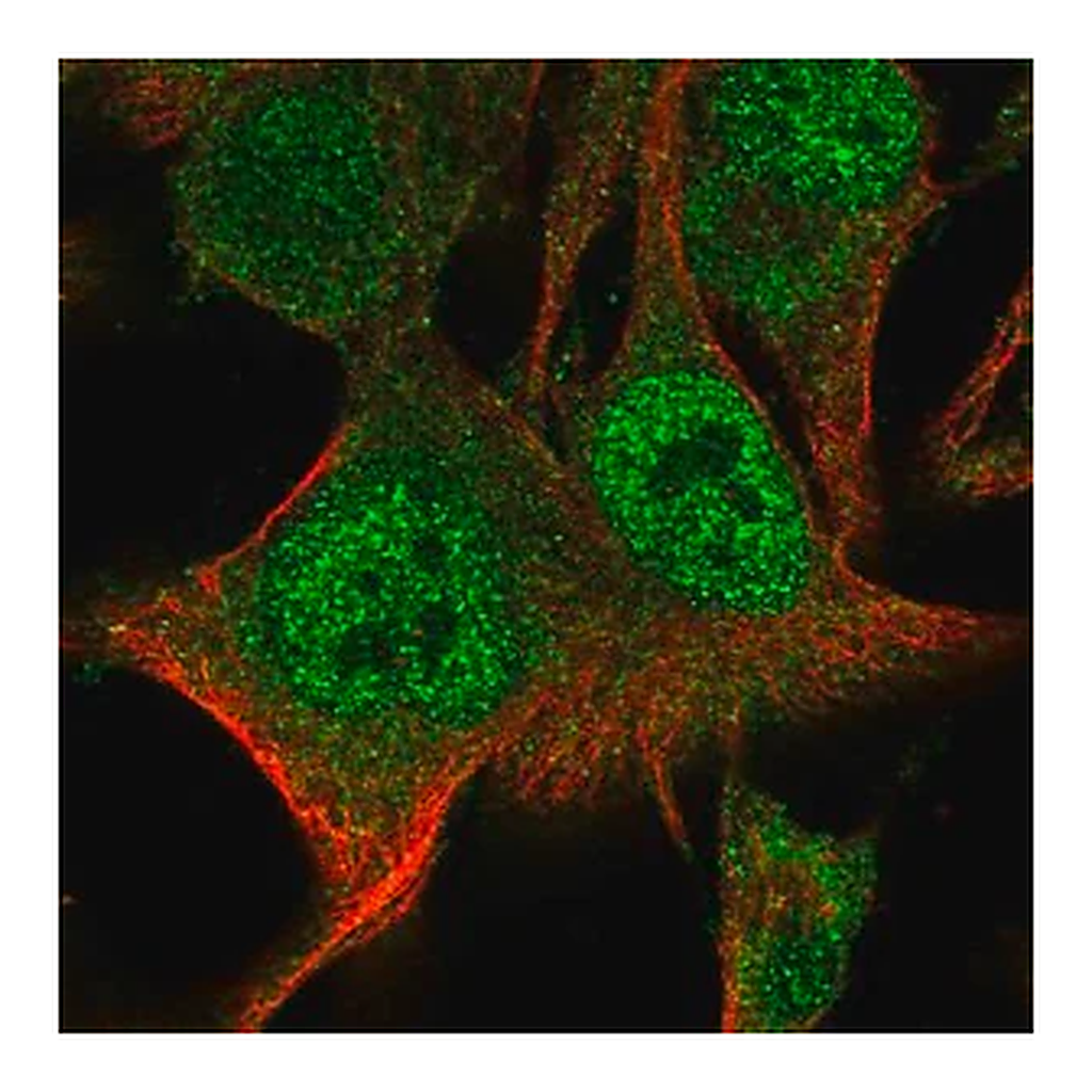 Merck Anti-PARP9 antibody produced in rabbit