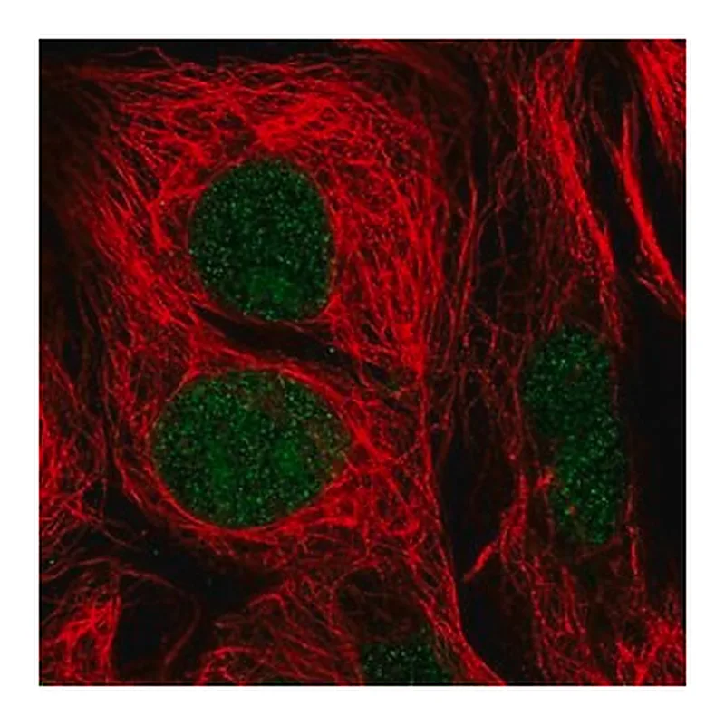 Merck Anti-GTF2E1 antibody produced in rabbit