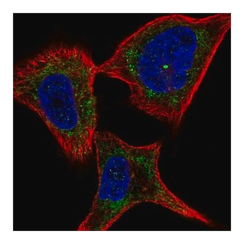 Merck Anti-PLXNC1 antibody produced in rabbit