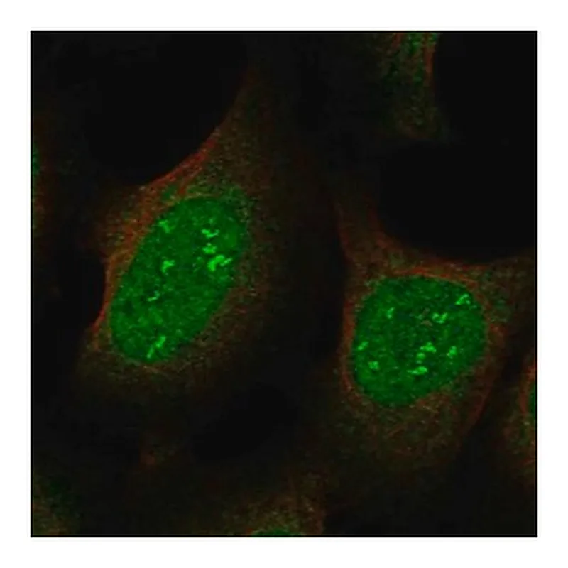 Merck Anti-JAZF1 antibody produced in rabbit
