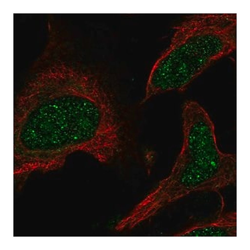 Merck Anti-PPARA antibody produced in rabbit