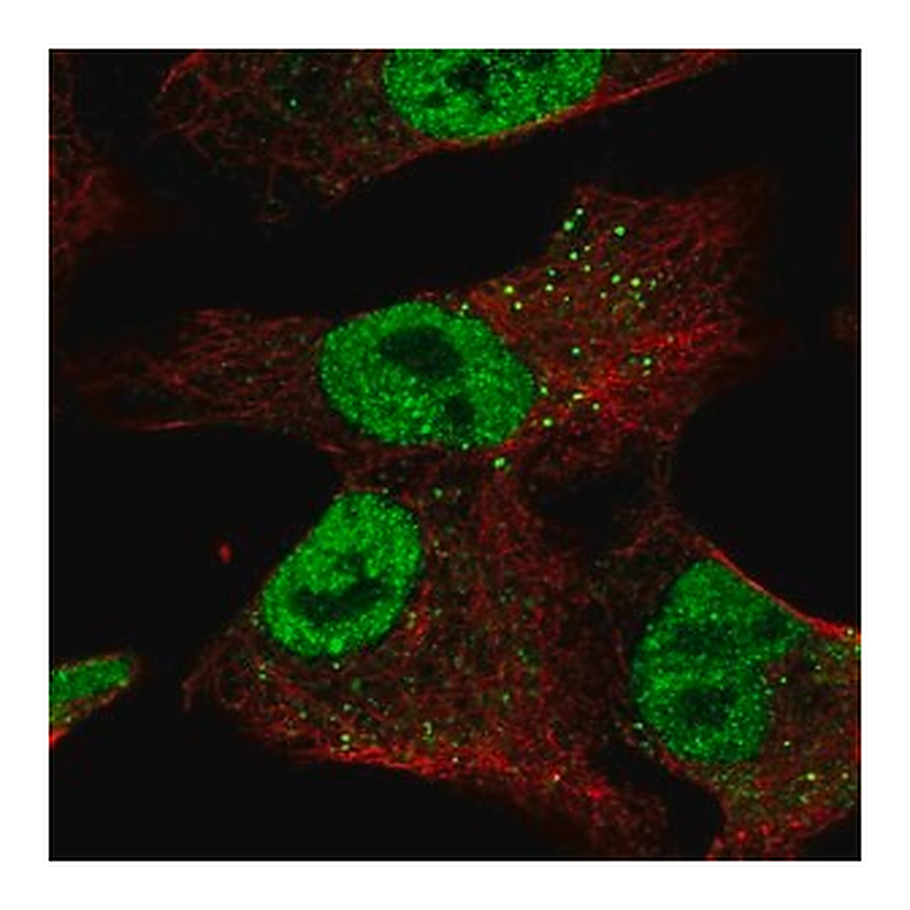 Merck Anti-ZNF341 antibody produced in rabbit