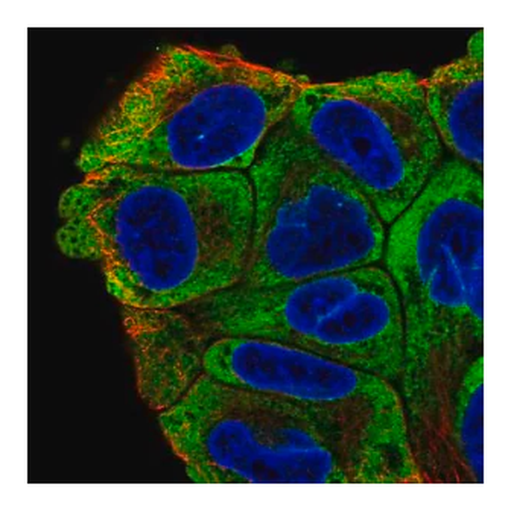 Merck Anti-PABPC1 antibody produced in rabbit