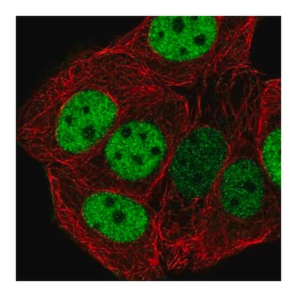 Merck Anti-CHTF18 antibody produced in rabbit
