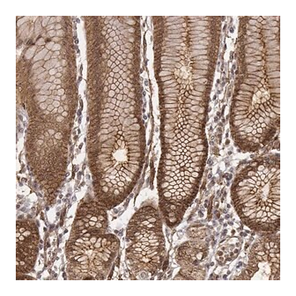 Merck Anti-ZFYVE19 antibody produced in rabbit | 캐시바이